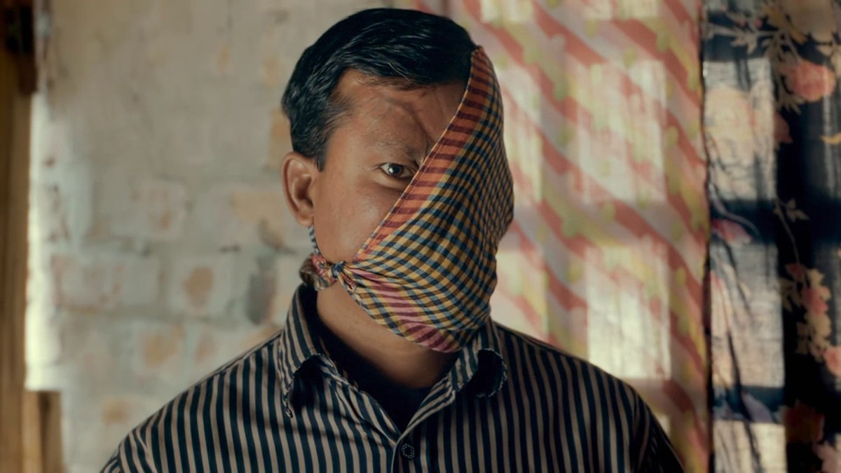 Body Bizarre: Hope for man who spent 23 years in hiding after his face ...