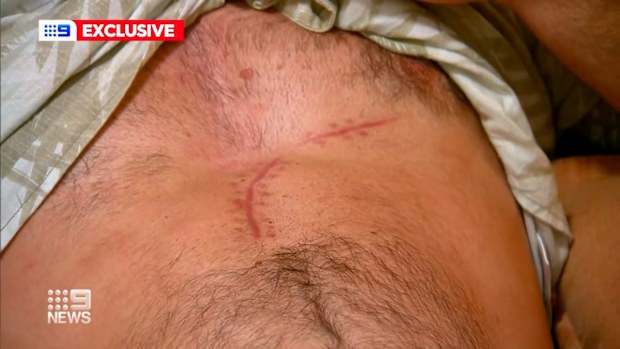 Ben Clarke was stabbed outside his Queensland home on Christmas Day.