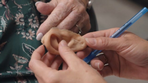 Karen returns for her third prosthetic ear after her pet dog mistakes it for a chew toy on Body Parts on 9Now.