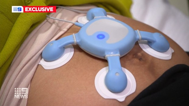 pregnancy: New device aims to flag birth complications | Nine.com.au