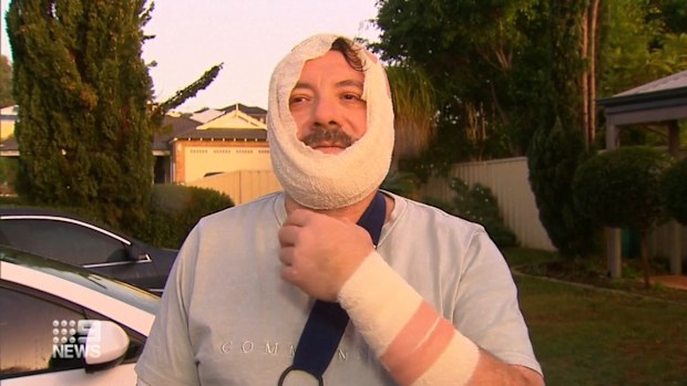 Steven Quayle suffered a deep gash to his neck and chin, and puncture wounds to his arms after blue heeler, Ace, turned on his Perth family.