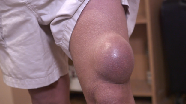 Dr Pimple Popper 9Now