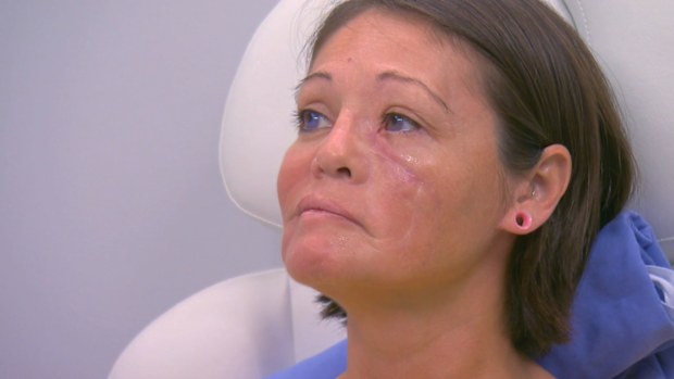 Botched 9Now