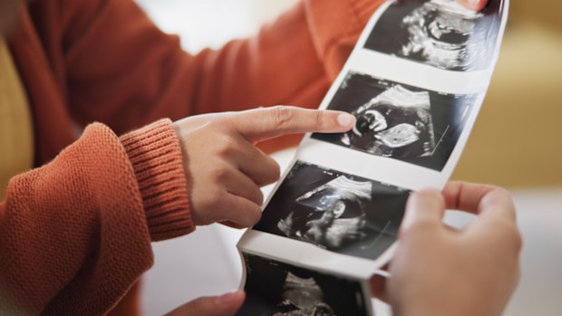 Ultrasound photo, people looking at images