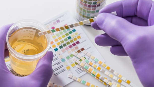 Test tires in violet gloves with test chart and urine can