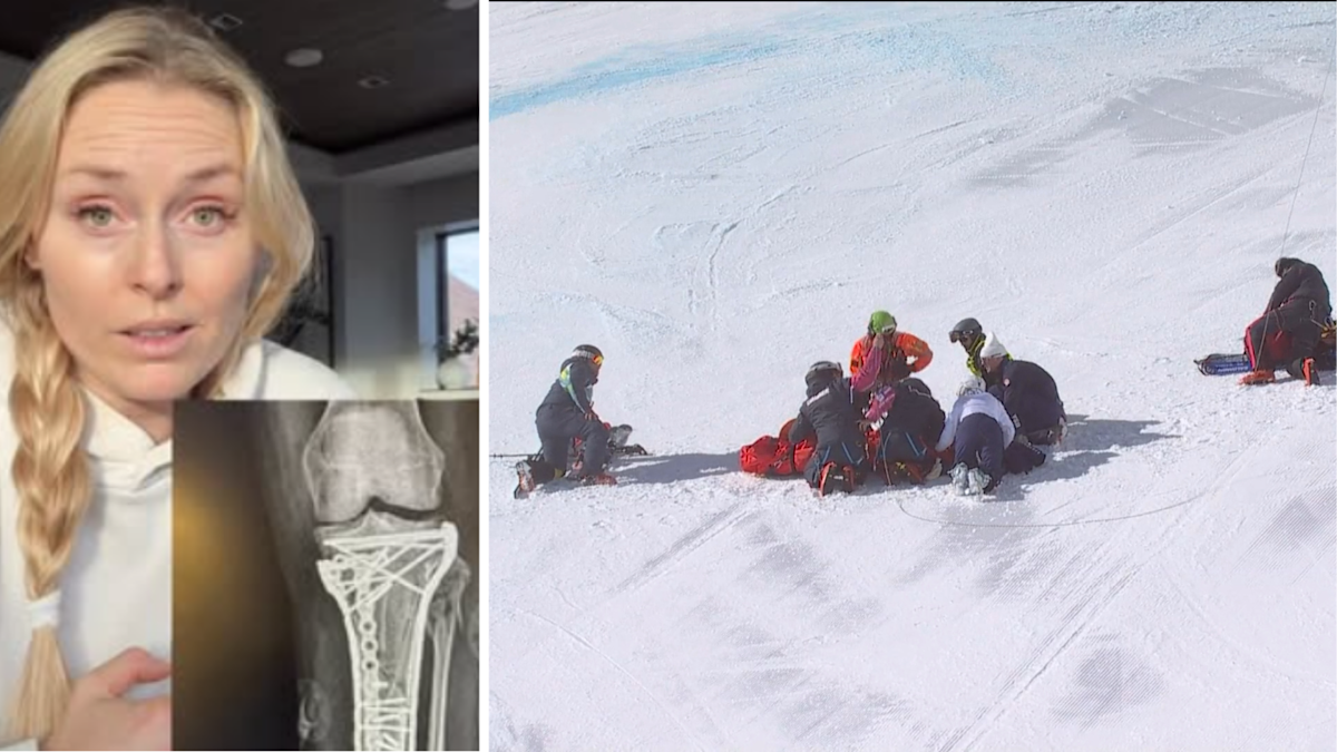 Vonn claims doctors almost amputated her leg