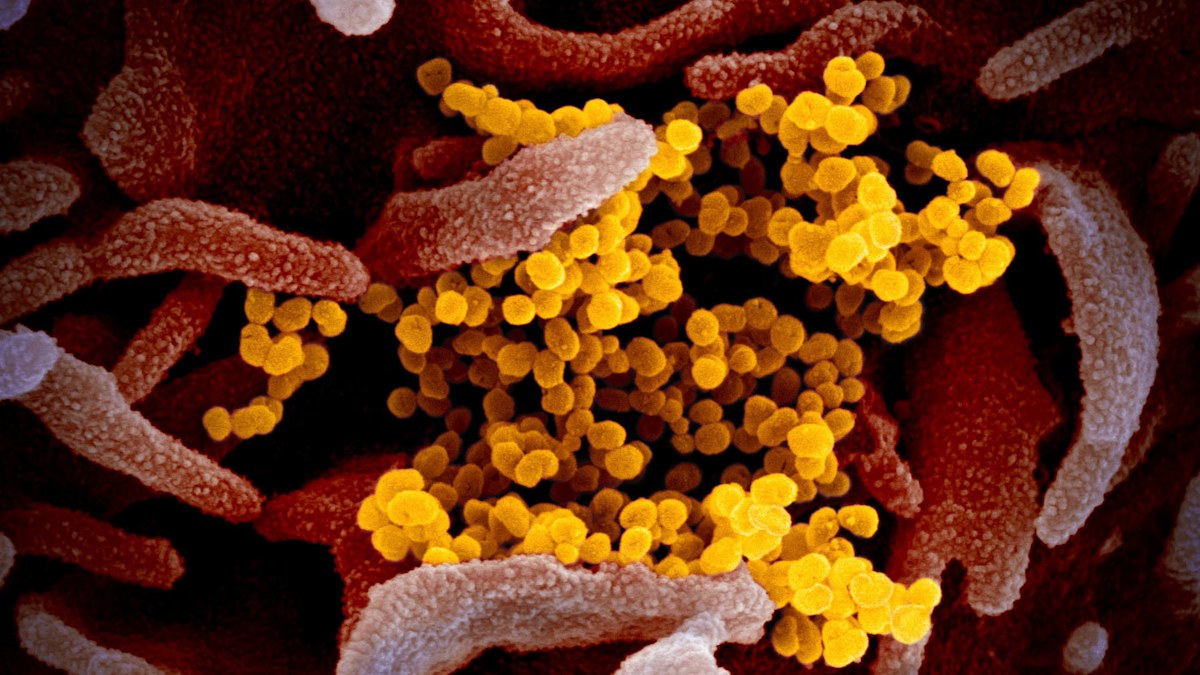 Coronavirus: New study suggests long COVID is similar to the flu | Nine ...