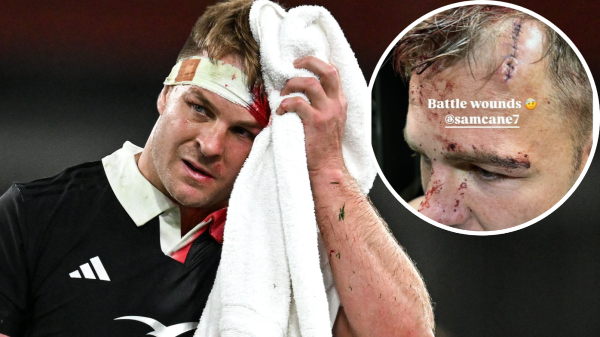 Rugby news 2024 All Blacks vs France, Sam Cane head injury, New