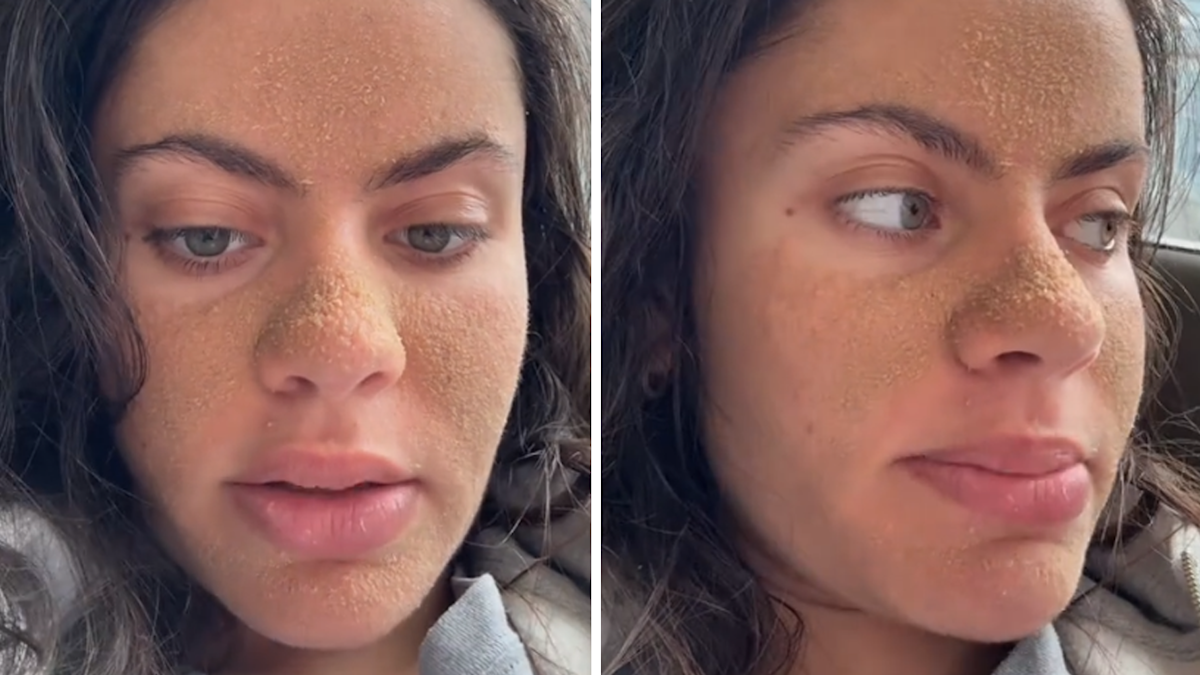 Caveman method: Dermatologist's warning about viral skincare routine ...