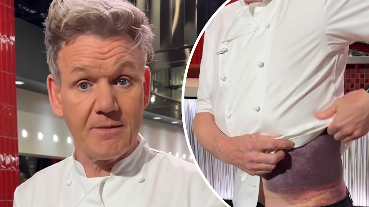 Gordon Ramsay shares details of horror cycling accident, shows ...