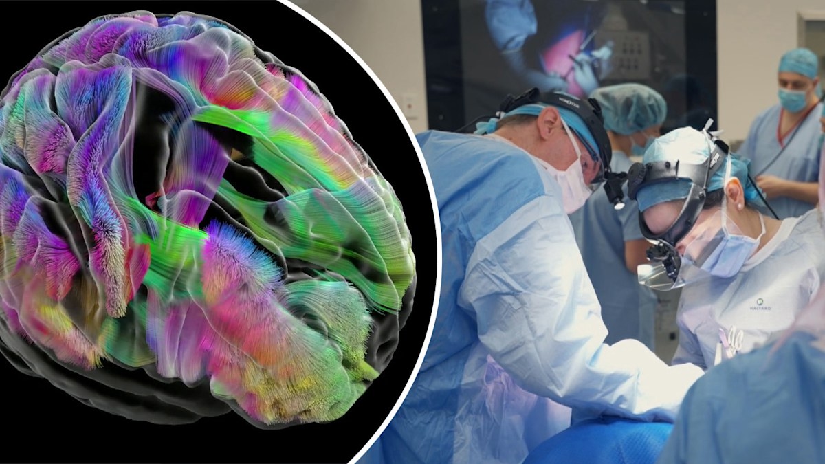 Multiple surgeries could lead to cognitive decline, study finds | Nine ...