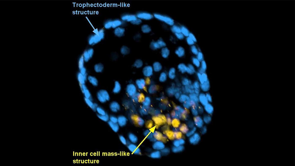 Australian scientists turn skin cells into human embryo-lookalike ...