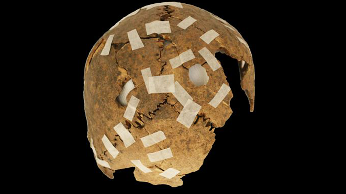 Inca discovery: How modified skulls helped civilisations' display of ...