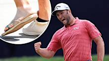 Jon Rahm has withdrawn from the US Open with a painful foot infection.