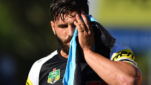 Josh Mansour fractures his cheek bone