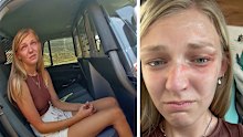 A selfie taken by Gabby Petito weeks before her death shows she had facial injuries on the day she and her fiancé Brian Laundrie were stopped by police investigating a domestic disturbance call, according to her family's lawyer.