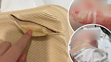 A Melbourne woman has sustained horror injuries after her hot water bottle burst while laying in bed.