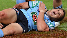 Brett Morris of the Blues screams in agony.