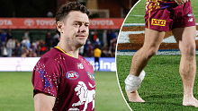 Lachie Neale was sighted with ice around his ankle post-match. 