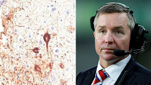 The impact of CTE can be seen clearly in Paul Green's brain scan.