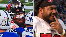 Vita Vea Loses Tooth