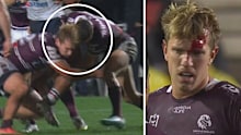 Ben Trbojevic and Luke Brooks clash heads.
