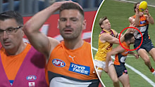 Stephen Coniglio's black eye.