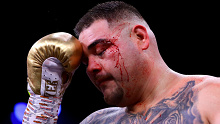 Andy Ruiz was cut early in the fight.