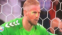 A laser is shined on Kasper Schmeichel's face.
