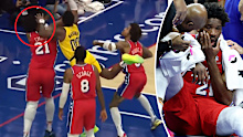 Joel Embiid was struck in the face.