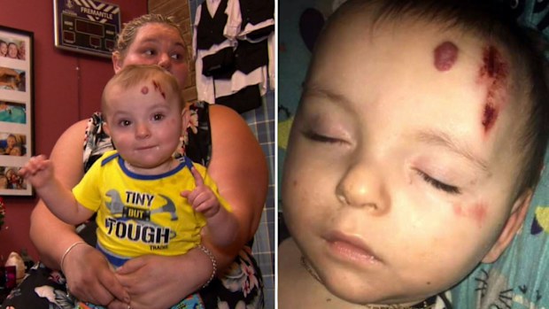One-year-old Xavier Cox had a large graze and was bleeding from his forehead.
