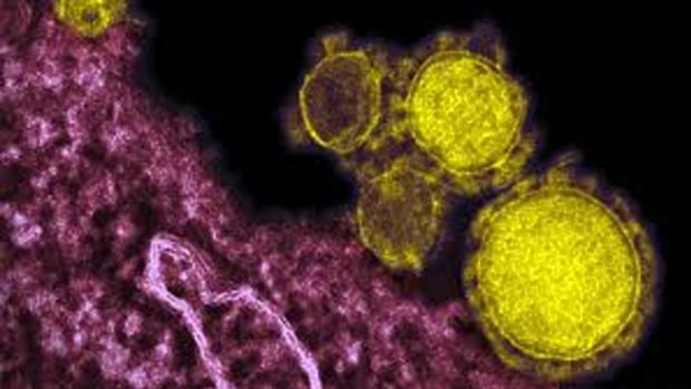 Coronavirus