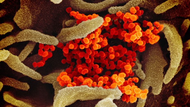 The Australian Government will donate $3 million towards coronavirus research in Australia.