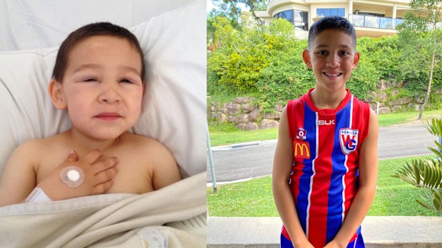 Jack Martin was also diagnosed with nephrotic disease when he was three