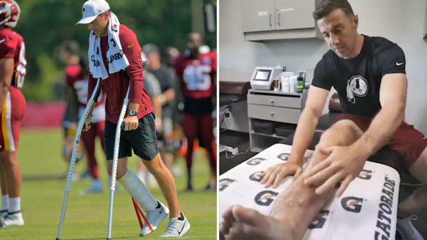 Alex Smith during his recovery from a horribly broken leg