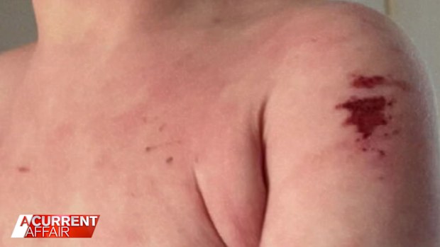 Emma Fisher said her son's condition is so bad, some days they can't even leave the house.