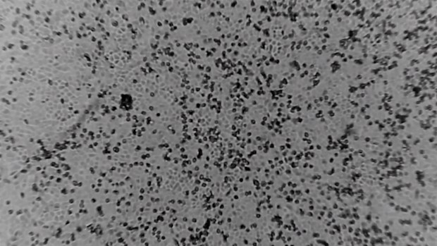 Researchers at Melbourne's Peter Doherty Institute for Infection and Immunity this week became the first to recreate the virus outside of China.