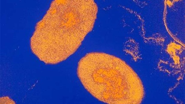 The whooping cough bacteria Bordetella pertussis seen under a microscope.