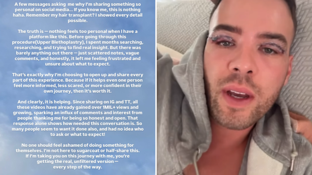MAFS NZ Samuel Levi eyelid surgery