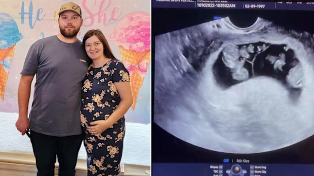 Shawn and Haylee were shocked to learn they were expecting quintuplets.