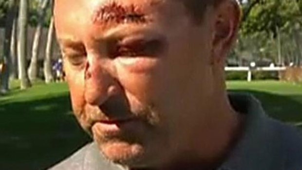 Robert Allenby after he was bashed in Hawaii. 
