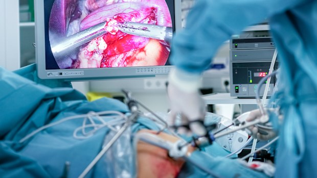 Bariatric surgery weight loss surgeon operating theatre gastric bypass 