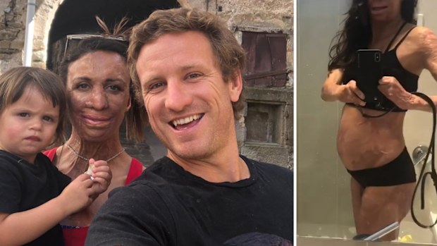 Turia Pitt and Michael Hoskins