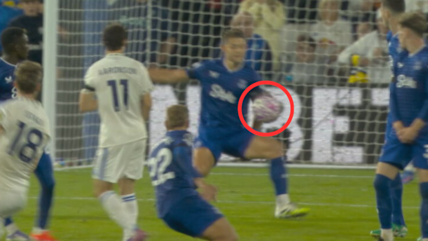 The James Tarkowski hand ball.