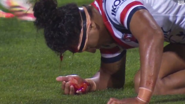 Sitili Tupouniua suffers a gruesome head gash.