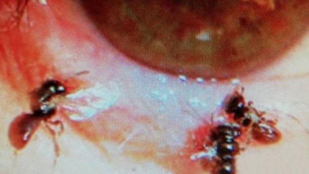 The insects were spotted in the microscope. 