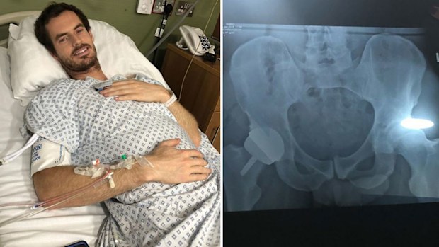 Andy Murray undergoes surgery
