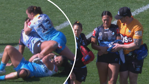 Annessa Biddle of the Sharks dislocates her elbow.