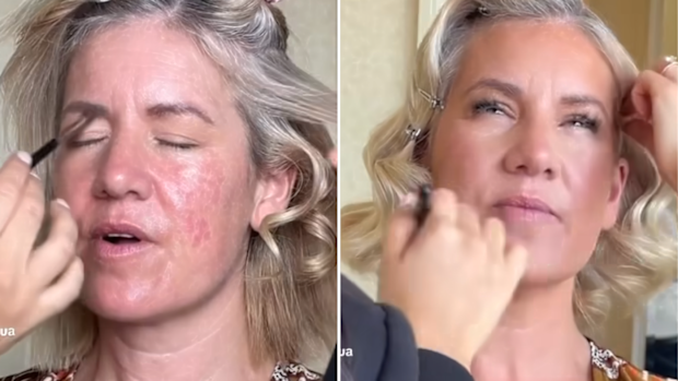 MAFS 2024 Lucinda Light skin insecurity
