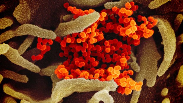COVID-19 as seen under a microscope.